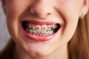 Orthodontie