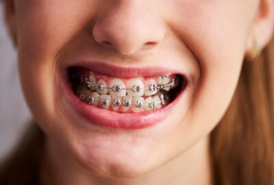 Orthodontie