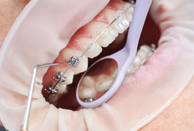 Orthodontie moderne