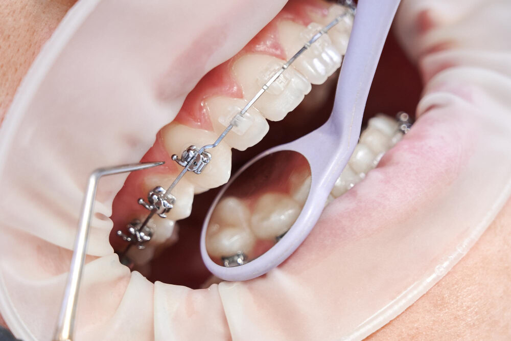 orthodontie moderne