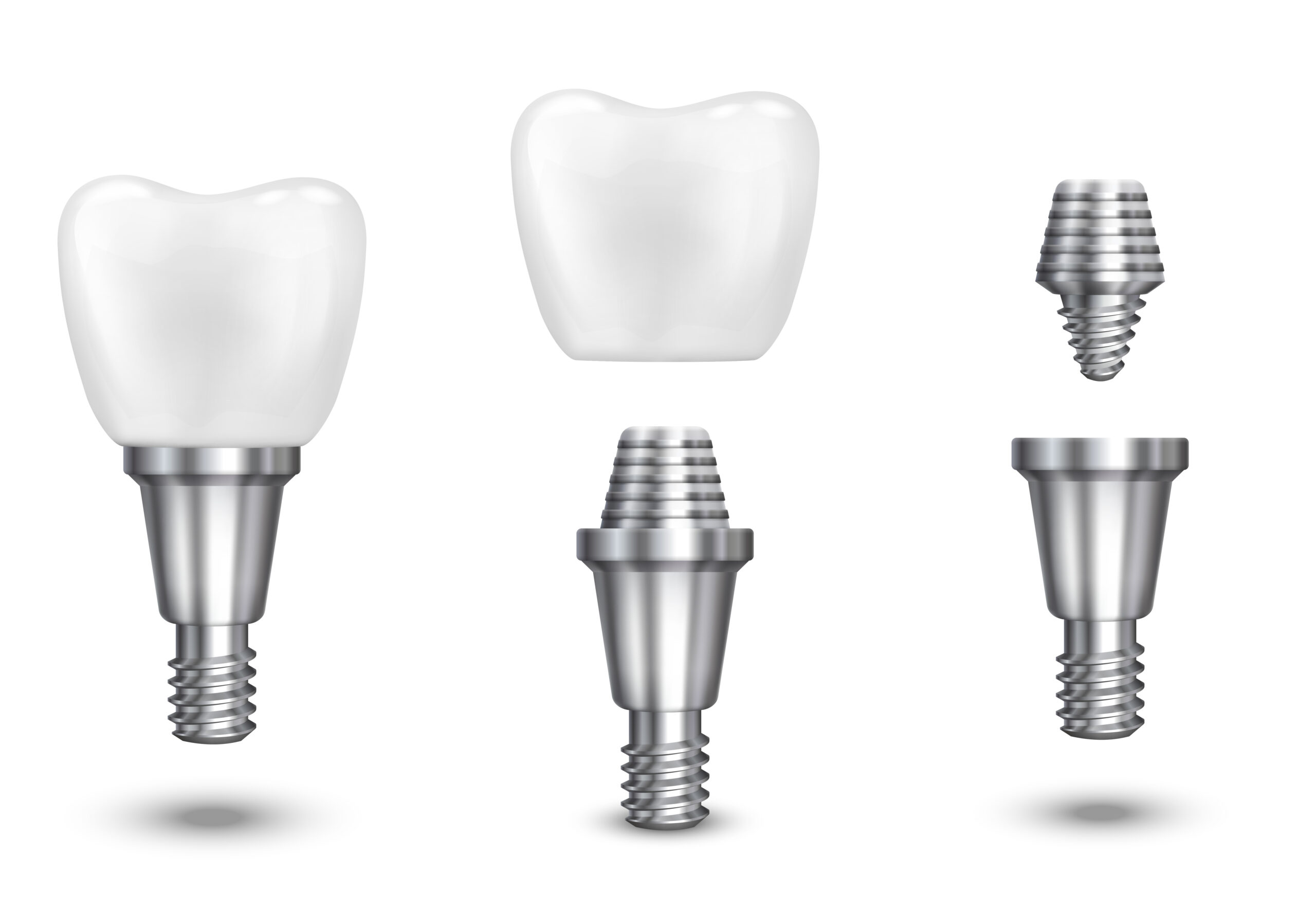 Implant dentaire