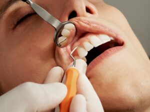 caries et risques cardiovasculaires