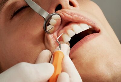 caries et risques cardiovasculaires